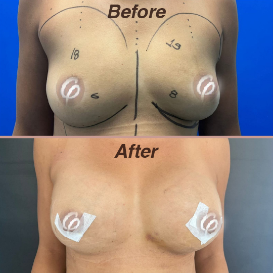 before and after-01