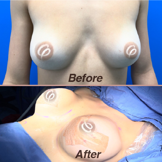 before and after-02