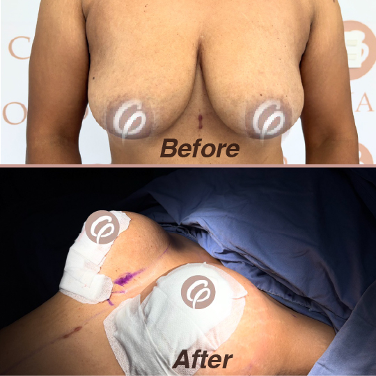 before and after-05