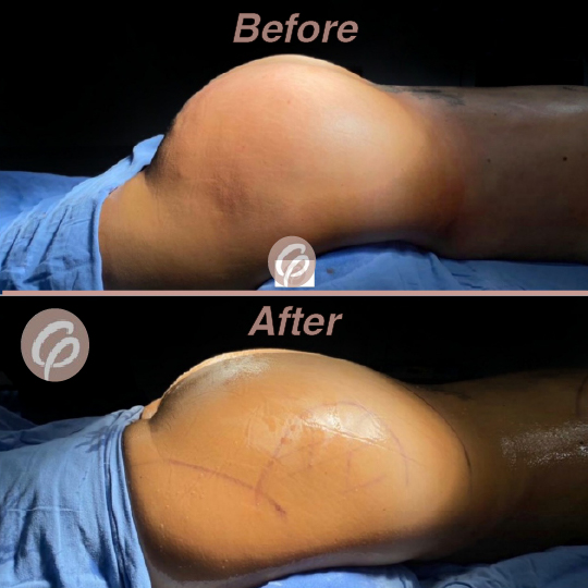 before and after-07