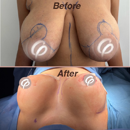 before and after-08