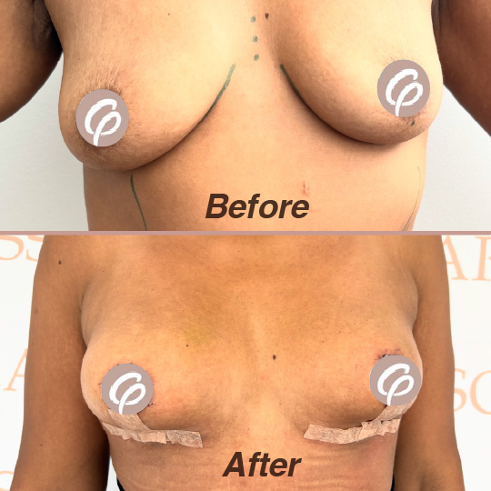before and after-10