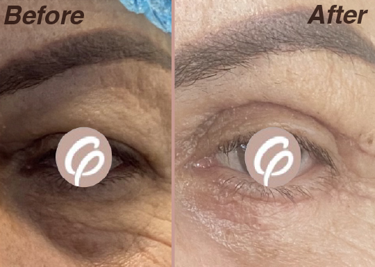 before and after-19