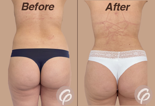 before and after-22